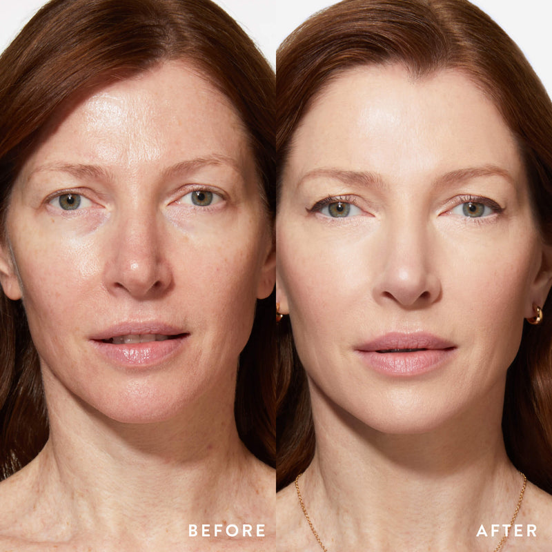 Better, Brighter Skin Kit Model B&A